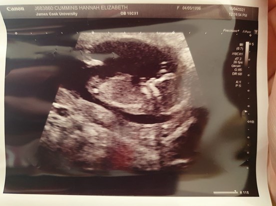 And now you have another grandchild on the way as Tony and Hannah have announced she is pregnant and due in October