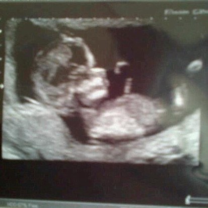 your great grandchild i know you know if its a boy or a girl already i cant wait to find out xxxxxx