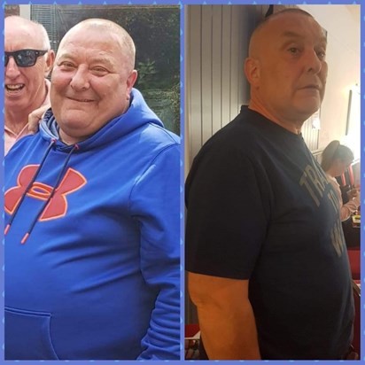 Before and after losing 7.5stone