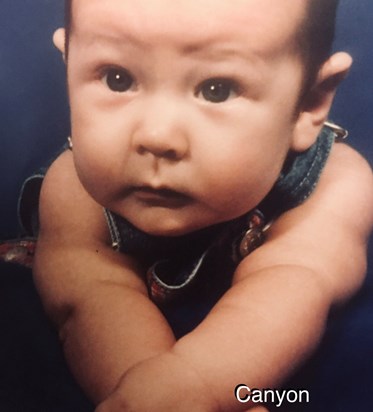 Canyon @6months old diagnosis is grave, infantile epilepsy:jackknife seizures beginning actar gel injections daily 
