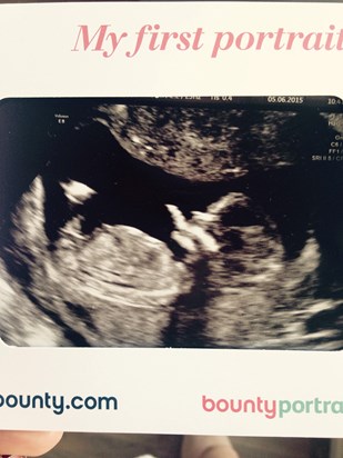 Baby number 5