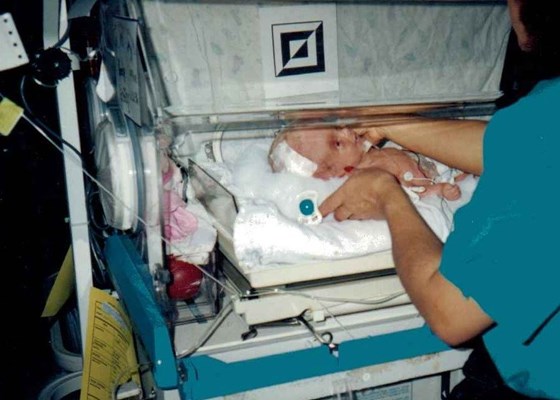 back in the NICU after surgery 6.21.96