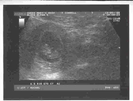 Baby O'Reilly - first scan 8 weeks