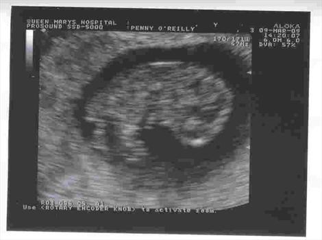 our first scan of Charles
