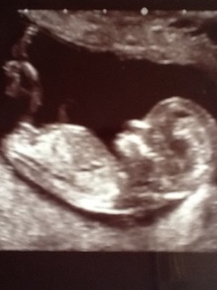 Denzel's 12 wk scan  he was perfect!!!