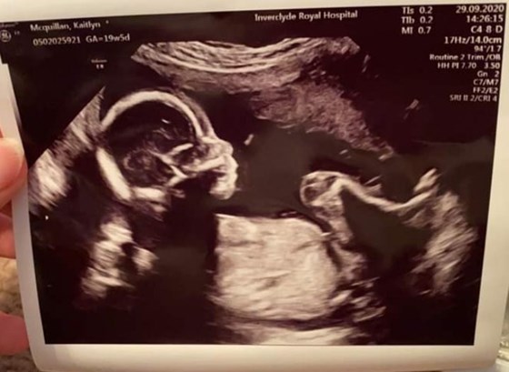 First great granddaughter 20 week scan , wish you could have got to meet her Dad ?? 