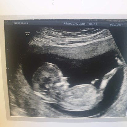 Well you probably already no who’s scan it is ur guna be a grandad to another baby boy ????????