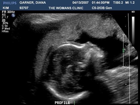 Baby Garner 005