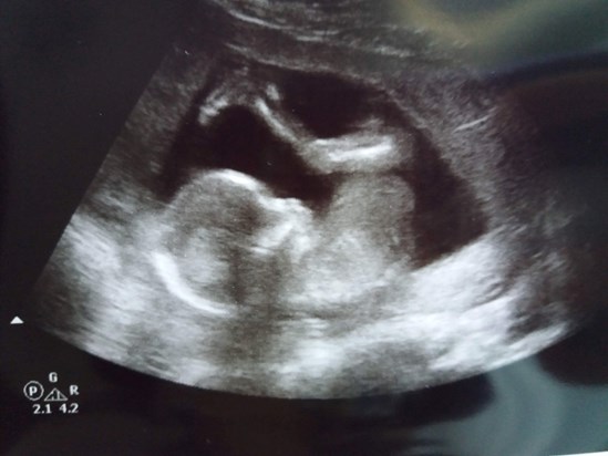 16 weeks scan, when we found out we were going to have a boy, a Theodore. 