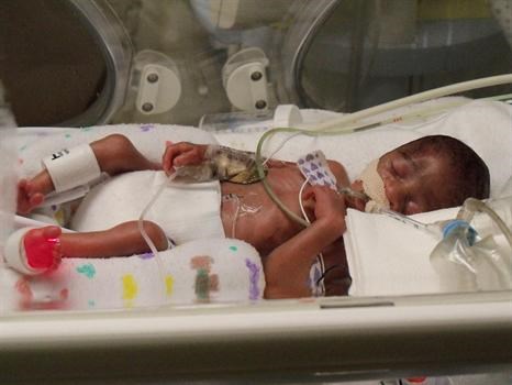 Ayden Joshua Williams. Born March 18, 2010, preeclampsia premature birth. Passed on April 6, 2010.