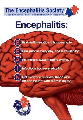 Encephalitis