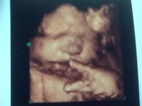 PEACE!!  our 4D ultrasound was AMAZING!