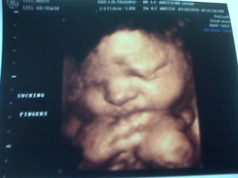 Our first look at our baby boy!! HUNGRY of course!!