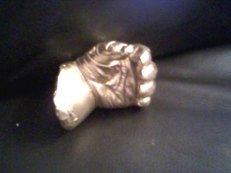 Devon's hand cast