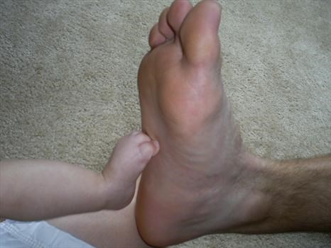 Scott and Kathryn's foot