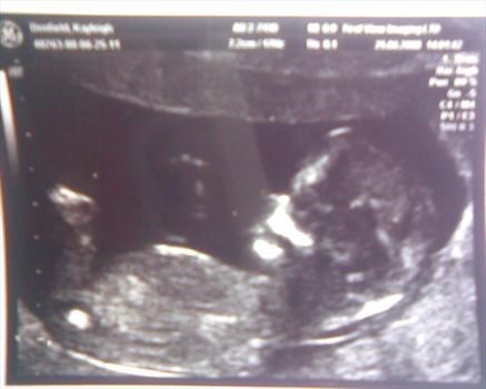 12 week scan, the first time we saw you growing