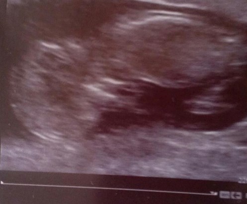 the very 1st pic of freddie xx