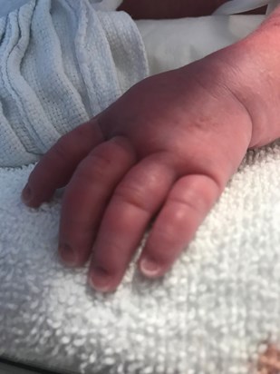 Annabelle's beautiful hand, shortly after she was born