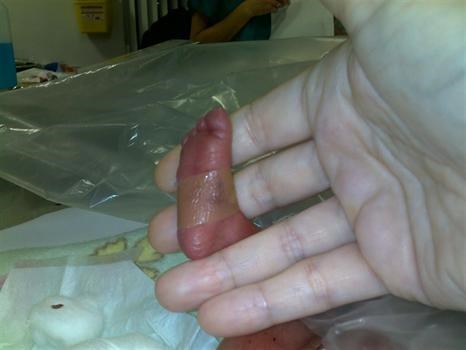 Tiny little foot - only 3 fingers long...