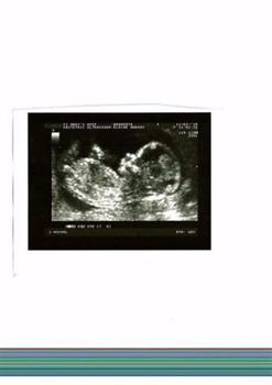 Megan at 12 week scan, she yawned soon after to let us know she was bored of posing (2)