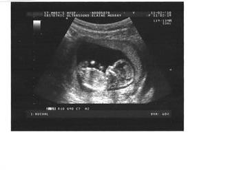 Megan at 12 week scan, sonographer said she was best behaved baby turning at all the right times