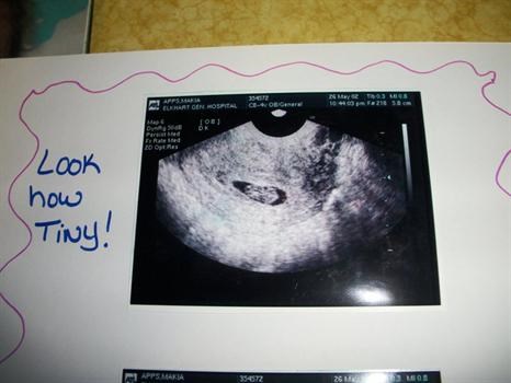 Kaitlyn first scan