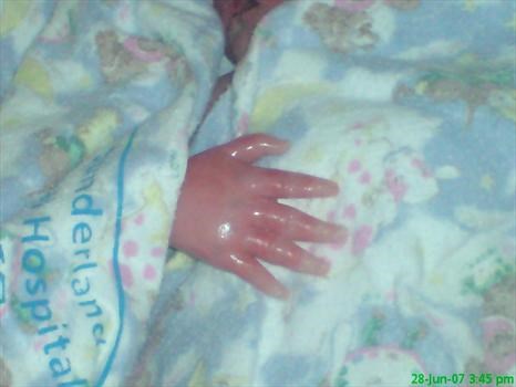 Neive's hand just like her mammy's!