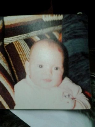 Mummy as a baby strawberry birth mark on head.xxx