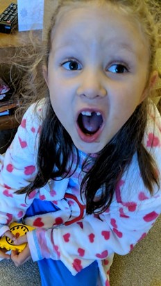 Losing your 1st tooth 