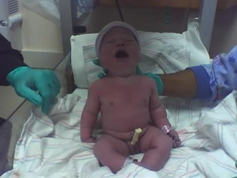 your lil sister LillyAnn 8.4 lbs and 18in.