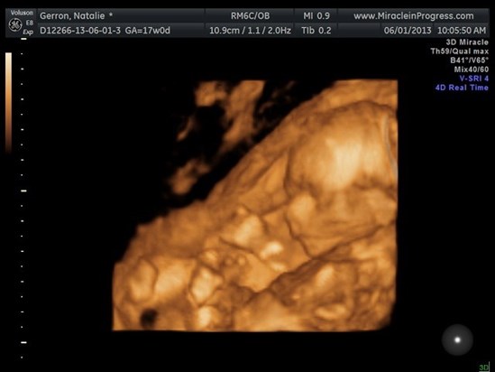 Ultrasound - 17 weeks - When we found out he was a BOY