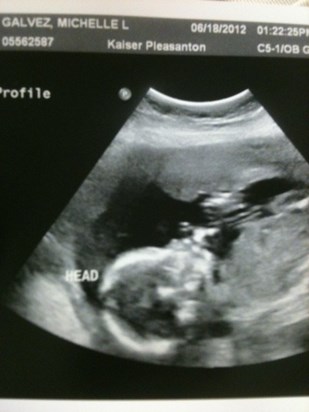 Alex's ultrasound